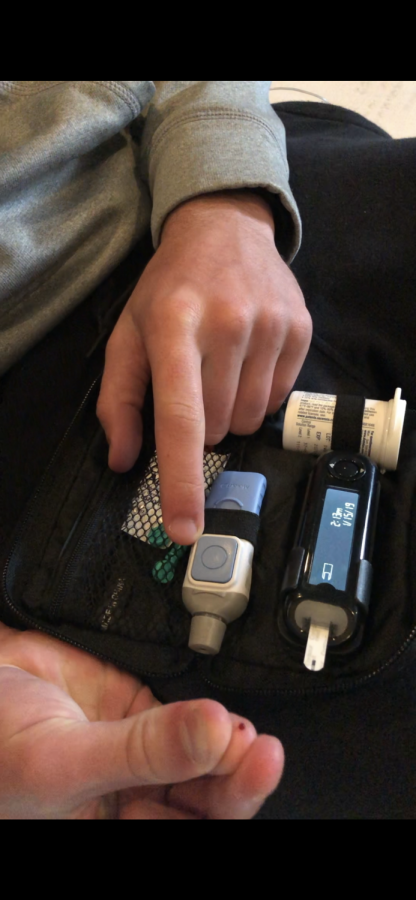 Nicholas Lemperis, senior, pricks his finger to check his blood sugar levels. Lemperis was diagnosed with type 1 diabetes in the first couple weeks of entering high school.